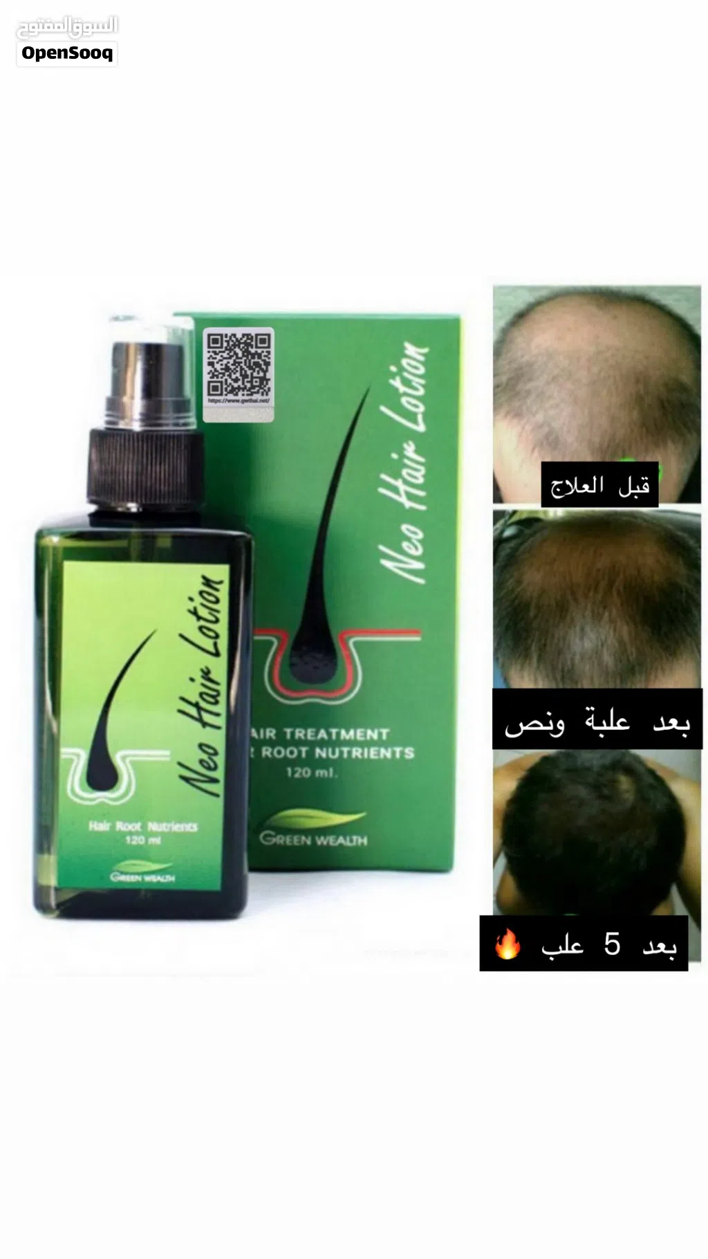 علاج الشعر nio hair lotion