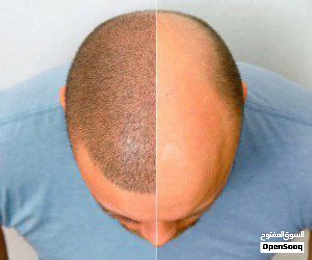 خدمات طب التجميل في ايران (مختلف المدن)