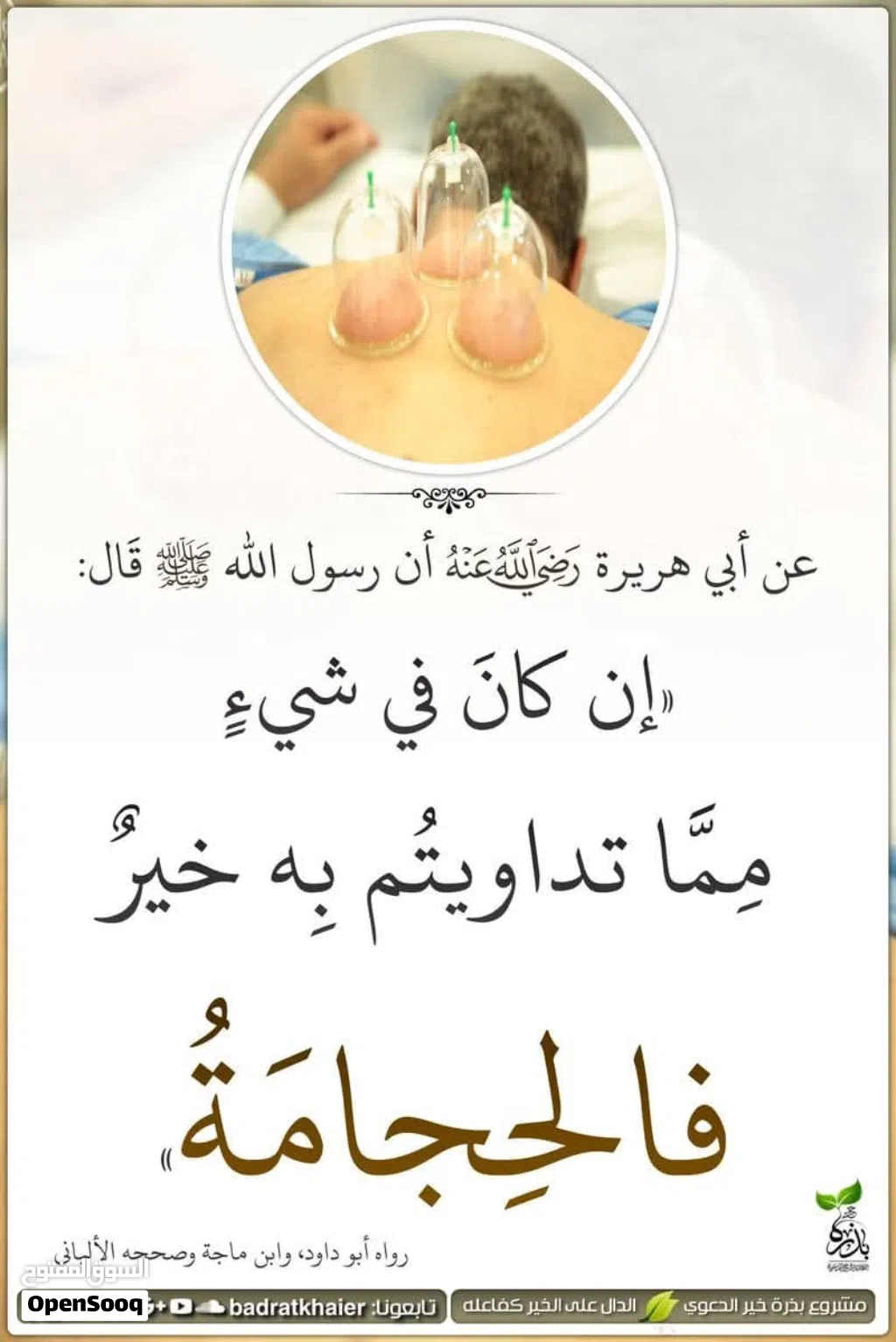 الحجامة شفاء بإذن الله