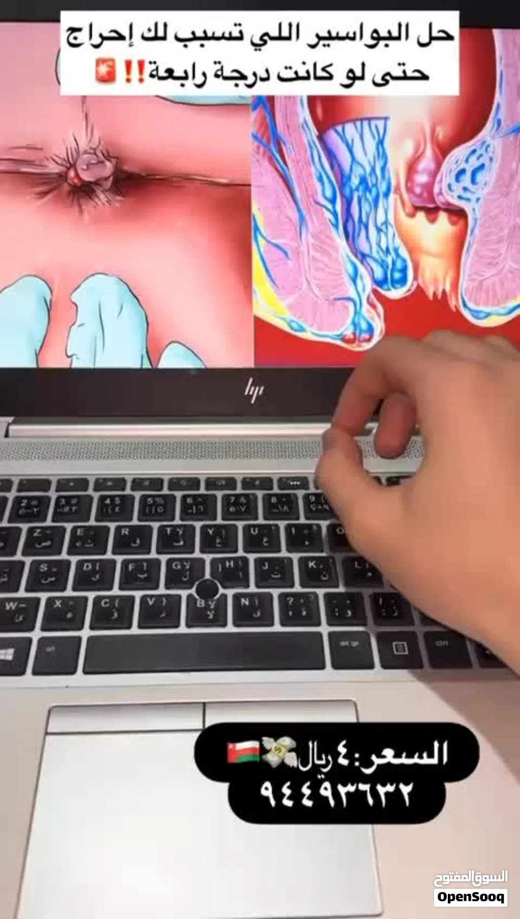 بخاخ هيربل العشبي