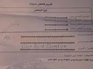 هيونداي ‏ايونيك ‏5 ‏2017