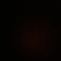 Nurse -Amman