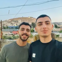 Dental Technician -Ramallah and Al-Bireh