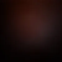 Hyundai ‏Avante ‏SE ‏2010
