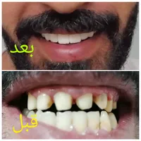 ابو يزن