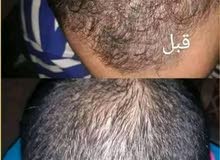 كورس علاجي للشعر الخفيف كورس علاجي للشعر الخفيف