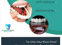 غطاء اسنان ((ابتسامة متحركة طبيعية))