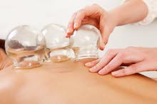 CUPPING THERAPIST NEEDED(HIJAMA) CUPPING THERAPIST NEEDED(HIJAMA)