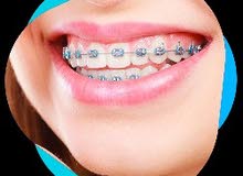 مطلوب طبيب استشاري او اخصائي تقويم اسنان