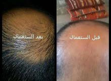 حل جميع مشاكل الشعر واللحية حل جميع مشاكل الشعر واللحية