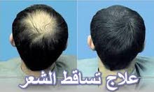 الحل النهائي لجميع مشاكل الشعر الحل النهائي لجميع مشاكل الشعر