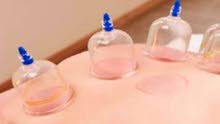 مطلوب اخصائية حجامة مطلوب اخصائية حجامة