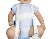 مشد خلع ولادة Pavlik Harness