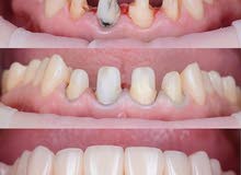 طبيب اسنان خبره في التجميل و التقويم و التركيبات