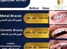 Best Discount for Dental Treatment, Best Dental and Derma Treatment