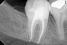 I have 4 years after master ,Syrian Endodontist looking for vacancy in Qatar.
R I have 4 years after master ,Syrian Endodontist looking for vacancy in Qatar.
R