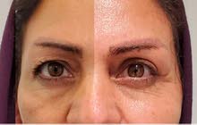 الدكتورة هدي صفایی
أخصائية الليزر و البشرة و الشعر ایران - ایلام الدكتورة هدي صفایی
أخصائية الليزر و البشرة و الشعر ایران - ایلام