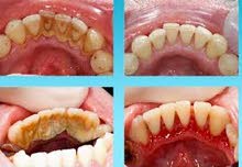 dental Hygienist أخصائي صحة الفم والأسنان يبحث عن عمل في مجال الصحة الفموية dental Hygienist dental Hygienist أخصائي صحة الفم والأسنان يبحث عن عمل في مجال الصحة الفموية dental Hygienist