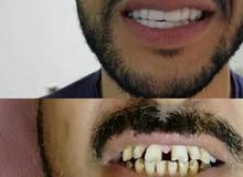 ابتسامه هوليود المتحركة ابتسامه هوليود المتحركة
