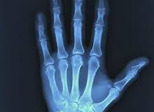 شراء صور اشعة X-RAY شراء صور اشعة X-RAY
