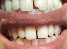 تجميل ومعالجة وتقويم الأسنان التجميلي المتقدم تجميل ومعالجة وتقويم الأسنان التجميلي المتقدم