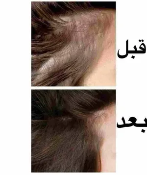 دكتوره اخصائيه شعر راسليني خاص