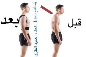 حزام المغناطيس الطبي لعلاج التحدب