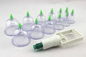 كاسات حجامه وجميع مستلزماتها