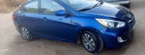 هيونداي اكسنت موديل 2017 امريكي