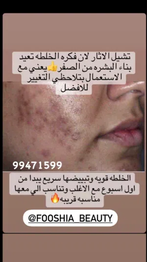 خلطات مبيض للبشرة ومضمون
