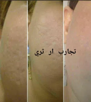ارتك سي اومگا 3 النقي والطبيعي