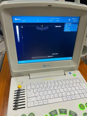 جهاز التراساوند (Ultrasound/2Brob)