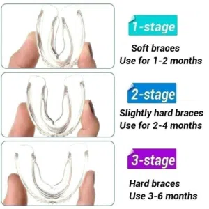Dental Orthodontic Teeth Corrector Braces