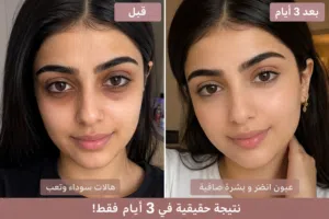 إذا عندكم هالات سودا ومضايقتكم كل يوم ، الحل في كريم الهالات السوداء هتخلصي من الهالات في 3 أيام فقط