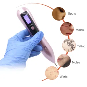 قلم البلازما جهاز ازالة الوشم و النمش و الزوائد والحميه و العناية بالبشره جهاز البلازماج شاشه وشحن