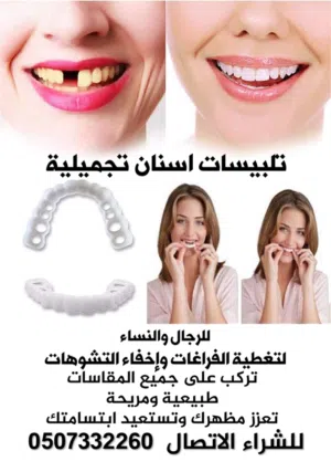 اغطية اسنان تجميلية