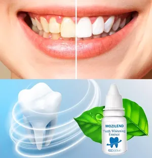 قطرة تبييض الاسنان لبياض الاسنان  القطره الطبيعيه تبييض الا سنان بشكل سريع