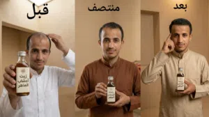 زيت أعشاب الماهر لعلاج الصلع ونمو الشعر