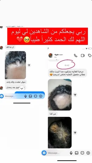 ‏العناية بالشعر ‏.‏ أخرى ‏.‏ جديد‏0