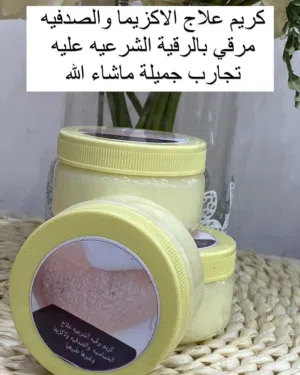 كريم الأكزيما والصدفية