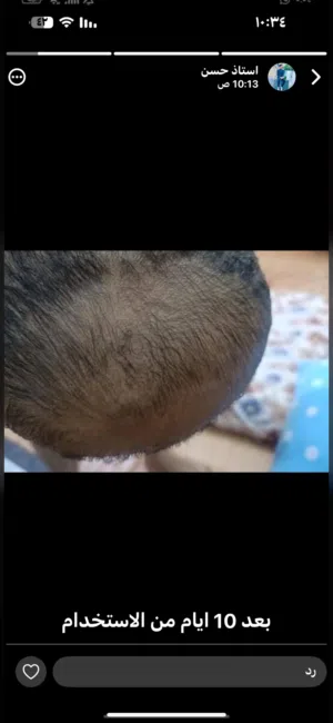 منتجات الدورة