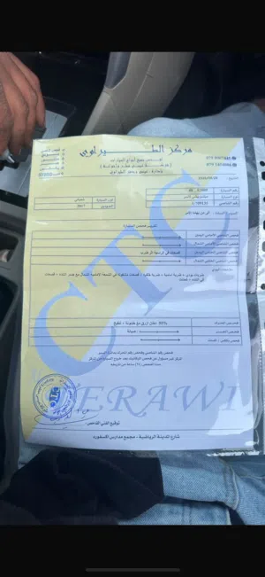 ميتسوبيشي لانسر 2017 للبيع ماتور 2000 قوي واقتصادي