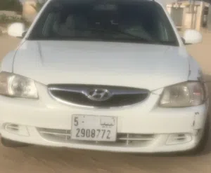 هونداي فيرنا 2013 للبيع او للتبديل
