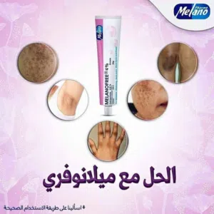 كريم ميلانو