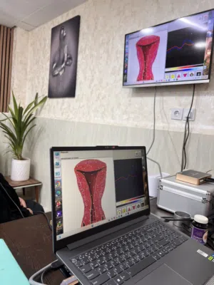 � جهاز حديث لتحليل الجسم بالذكاء الاصطناعي نتائج دقيقة خلال دقائق
