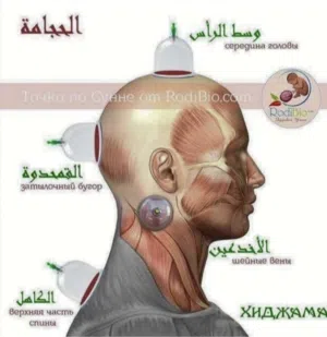 دوره لتعلم فن الحجامه تقدم لك ع يد خبير متخصص ف الحجامه لما يقارب 15 سنه