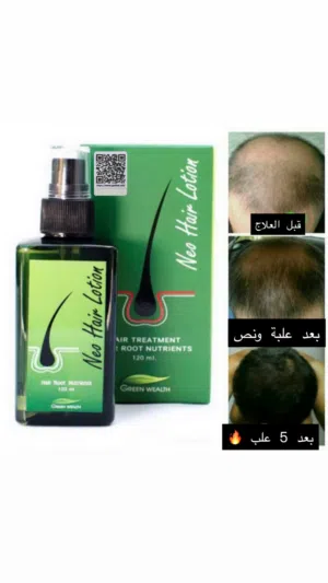 علاج الشعر nio hair lotion