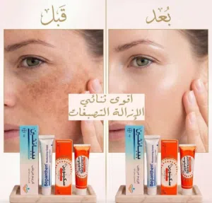 بكج ثنائي الإزالة التصبغات الوجه والجسم والمناطق الحساسة.