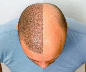 خدمات طب التجميل في ايران (مختلف المدن)