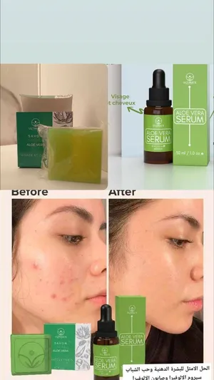 باقة علاج البشرة الدهنية و الحساسة او أي بشرة تعاني من حب شباب و التحسس هادي الباقة ليك